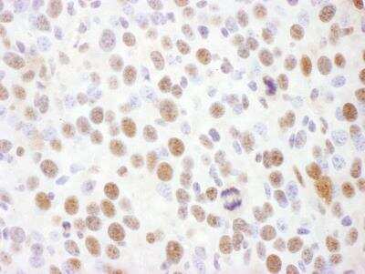 <b>Biological Strategies Validation. </b>Immunohistochemistry: Rad17 [p Ser645] Antibody [NB100-273] - Sample: FFPE section of mouse renal cell carcinoma. Antibody: Affinity purified rabbit anti-Phospho Rad17 (S645) used at a dilution of 1:1,000 (1ug/ml). Detection: DAB